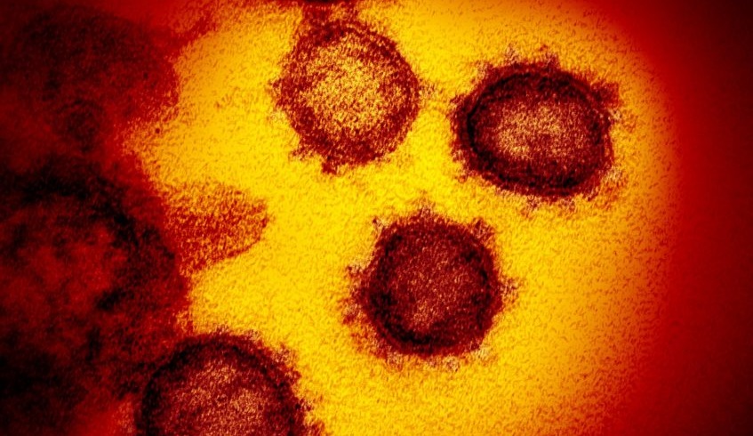 Covid long : la persistance du SARS-CoV-2 dans les muqueuses pourrait être en cause