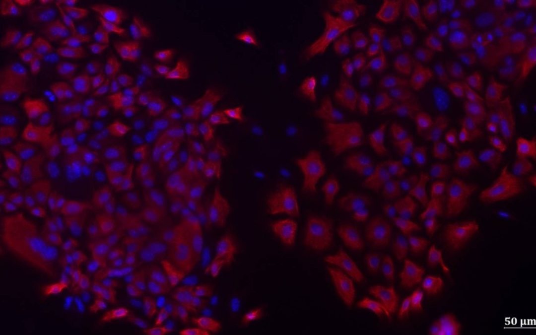 Bronchopneumopathie chronique obstructive : une mutation génétique confirmée comme facteur de prédisposition