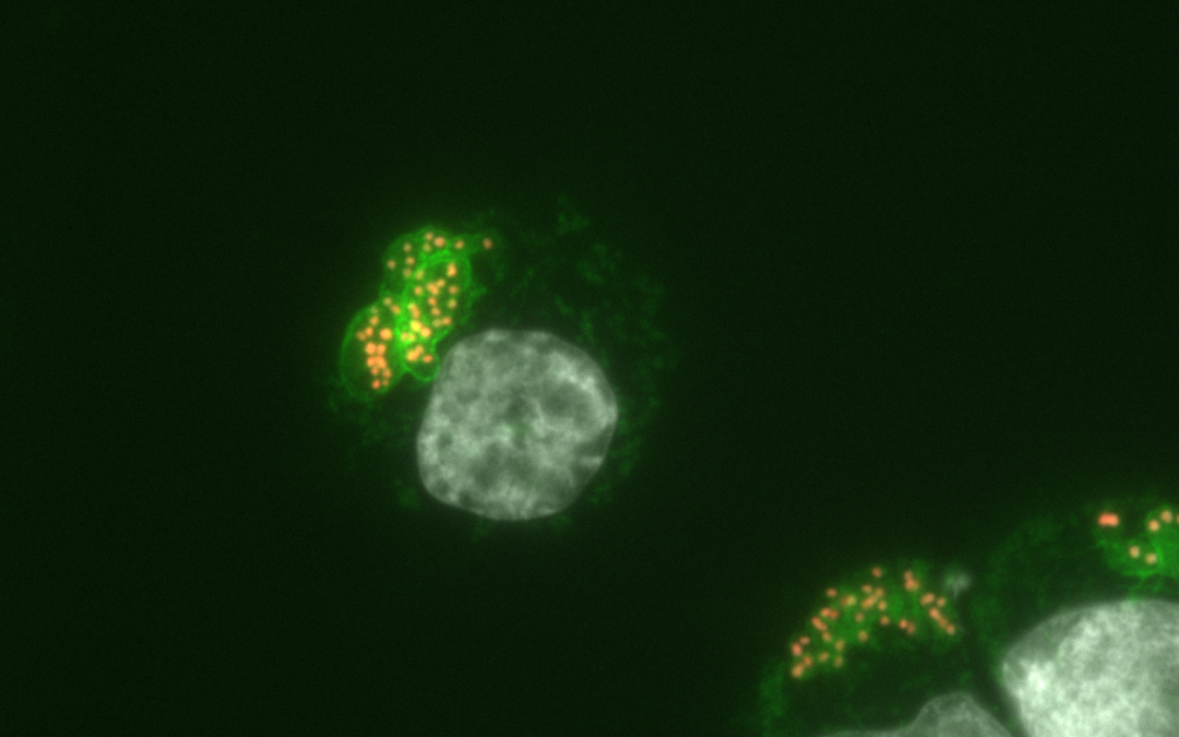 Parasite et cancer : une nouvelle approche épigénétique