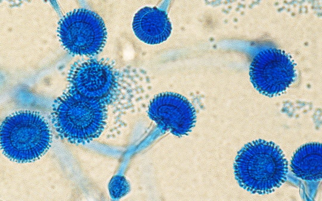 Un nouveau test PCR plus fiable pour détecter l’aspergillose invasive